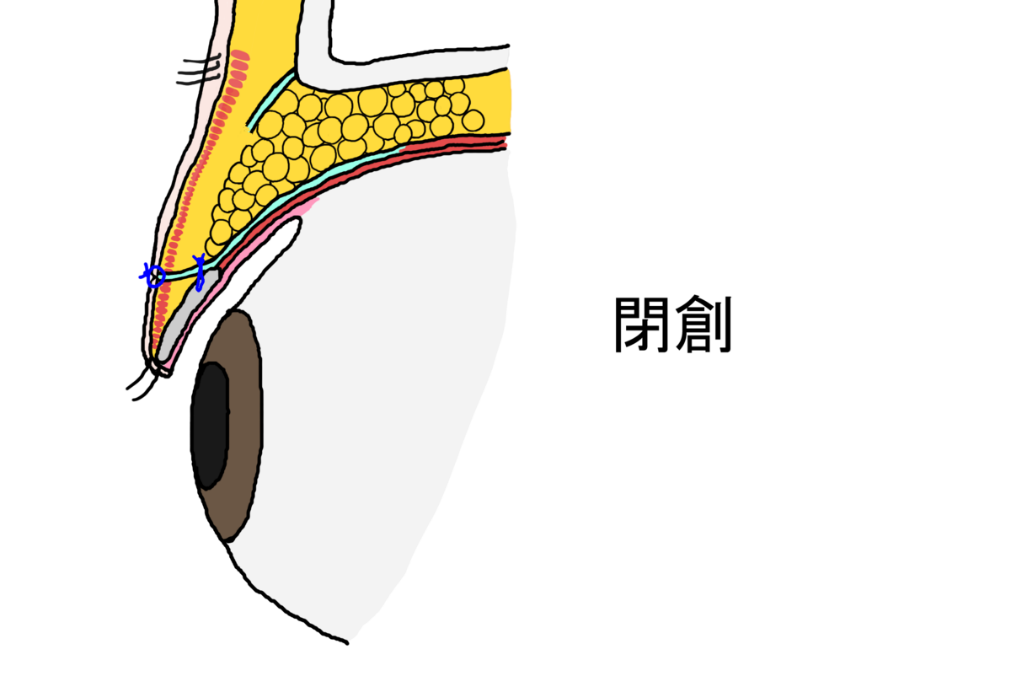 閉創